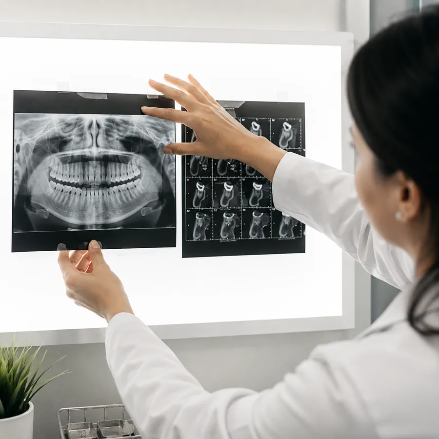 Beautiful confident smile — dental care at Arya Smiles